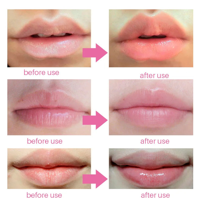 Mascarilla de labios con colágeno 10 unidades