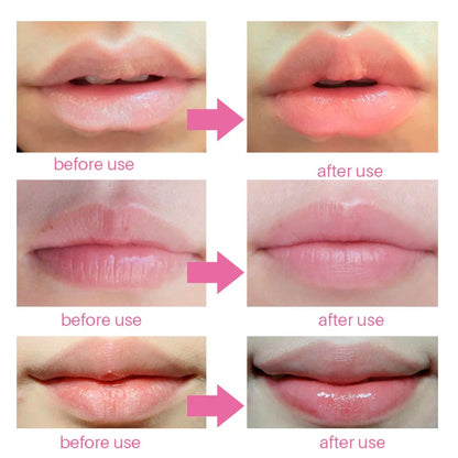 Mascarilla de labios con colágeno 10 unidades